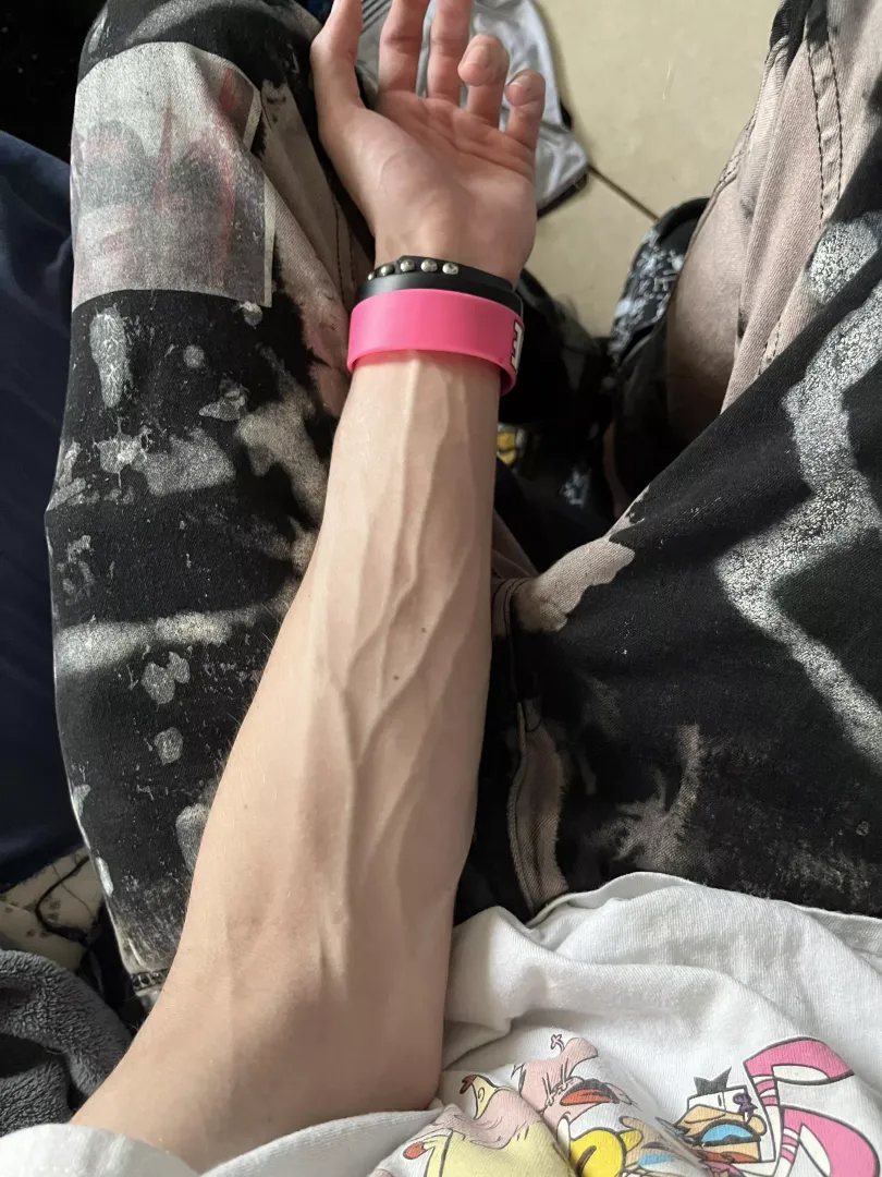 vascularity