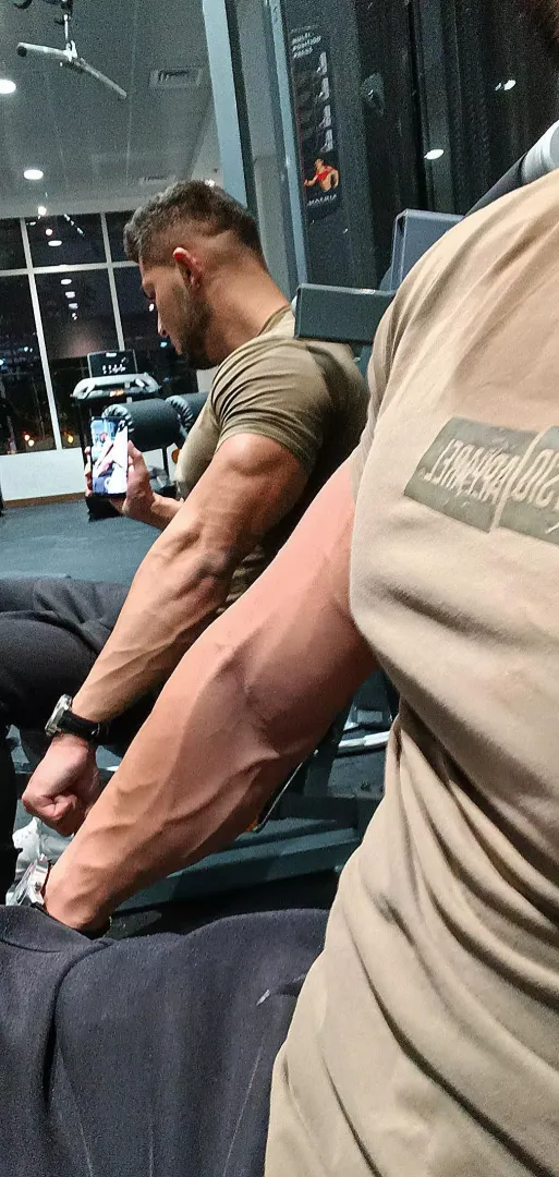 Veins everywhere