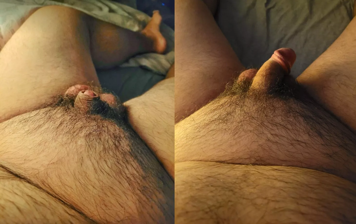 very elastic skin