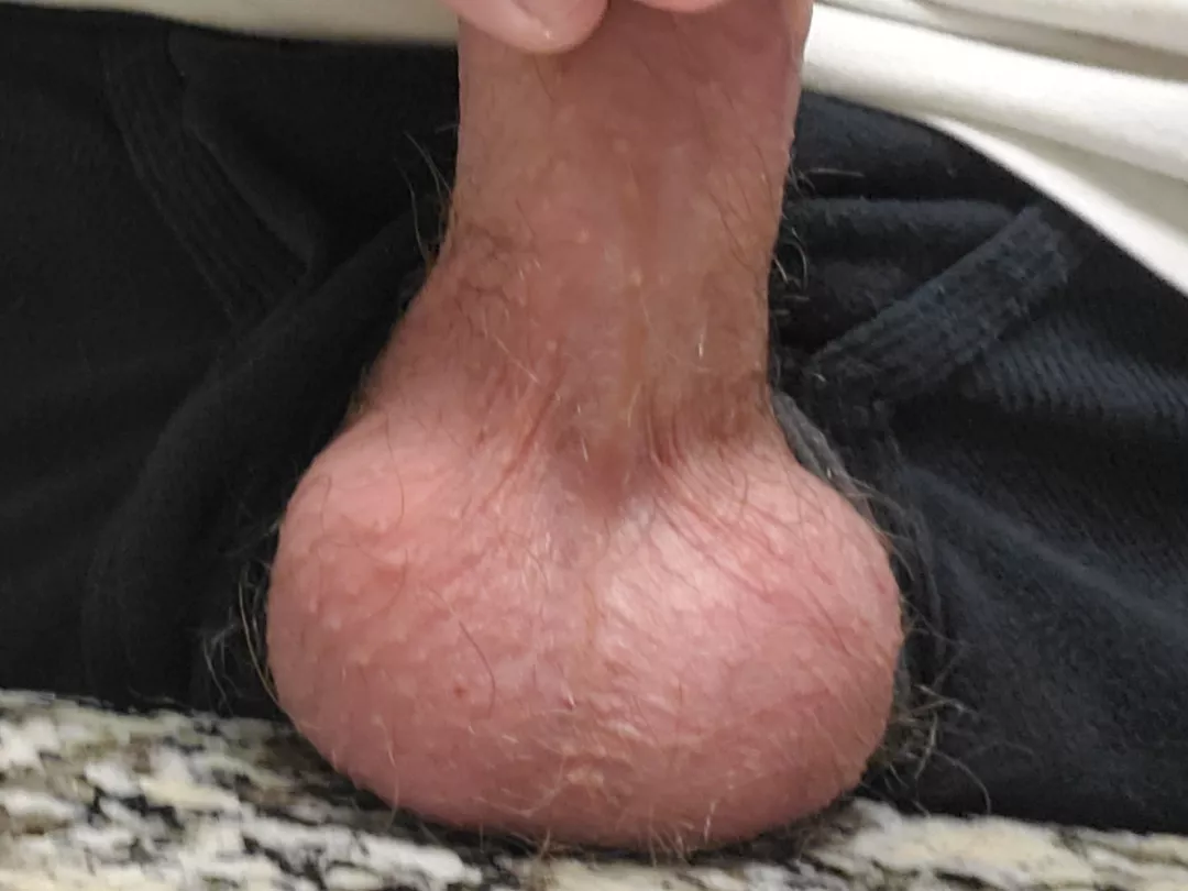 very much need drained