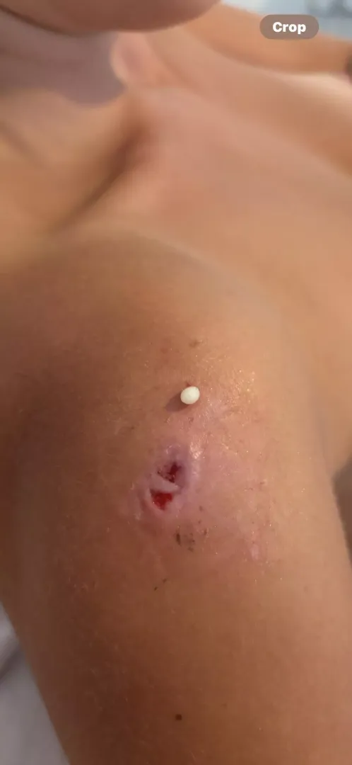 Videos- are there links to decent squeezing videos