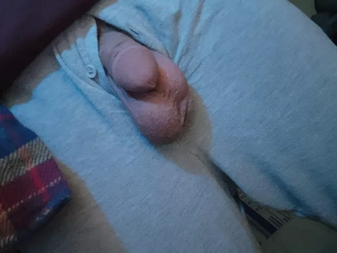 Warm balls [30]