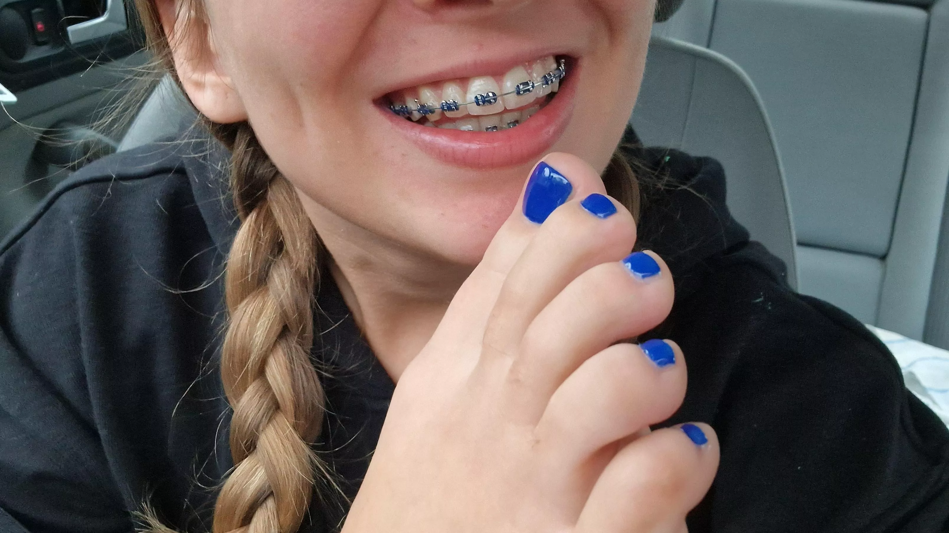 Wearing a big smile today [oc]