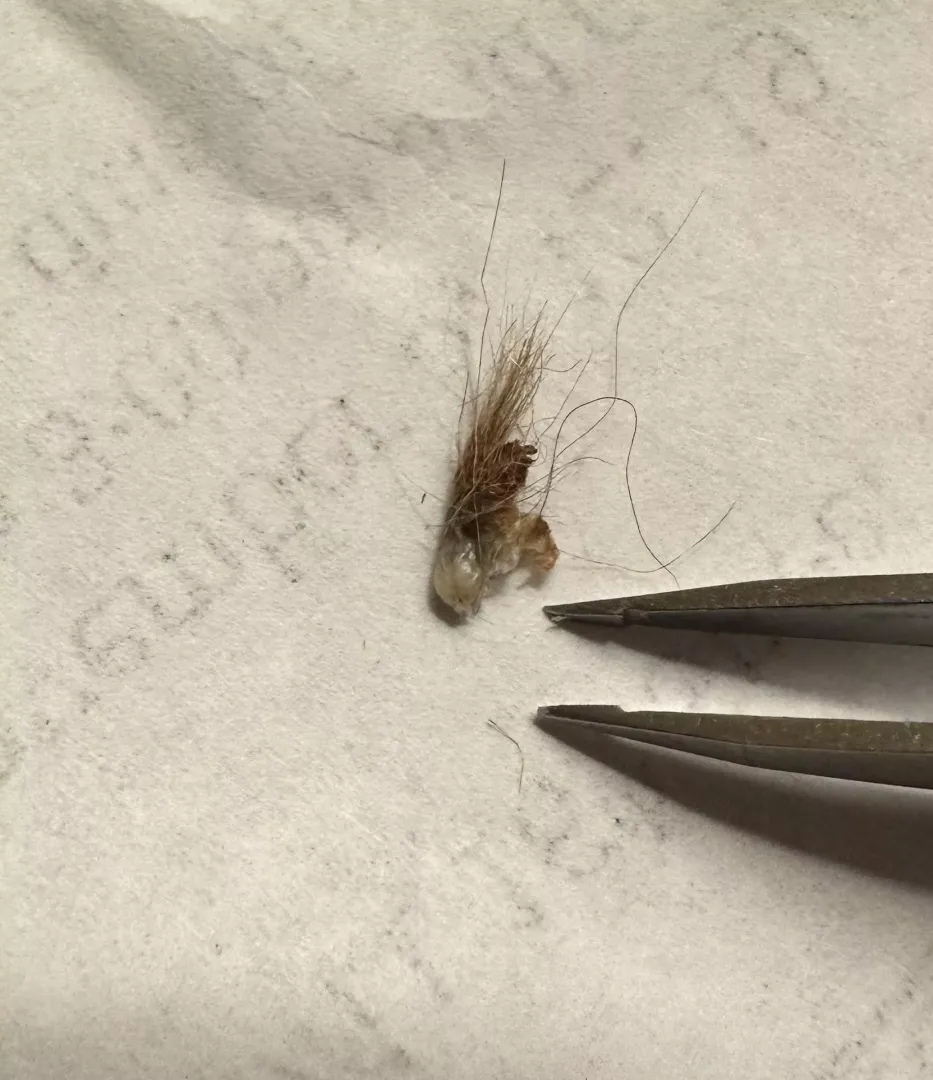 Went mining in husband’s belly button.