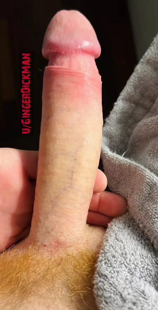 What about my ginger dick ?