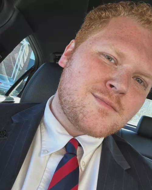 What do we think of the facial hair? 