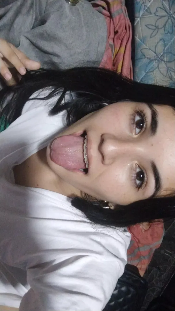 What does this angle remind you of? my braces accompany
