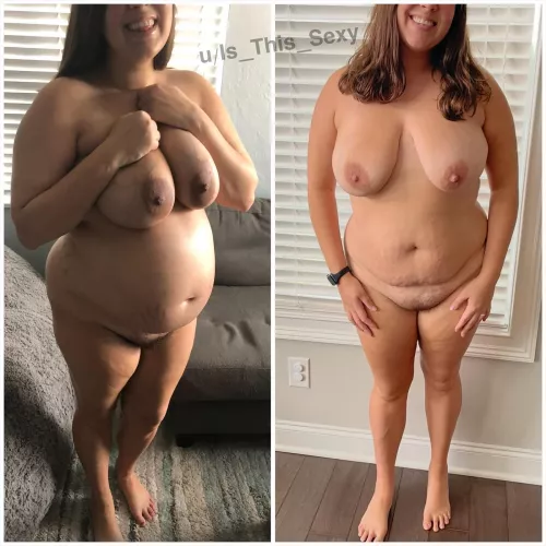 What pregnancy does to a woman’s body :)