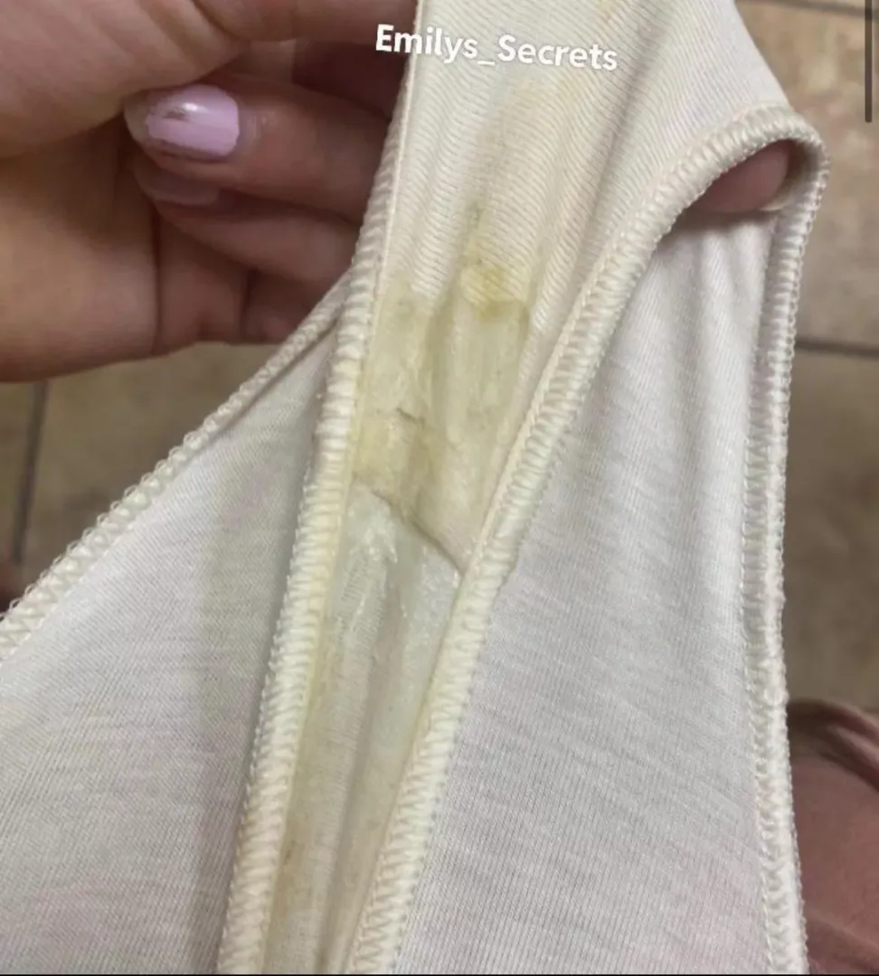 What would you do if you peeled these off me ? [f] 👀