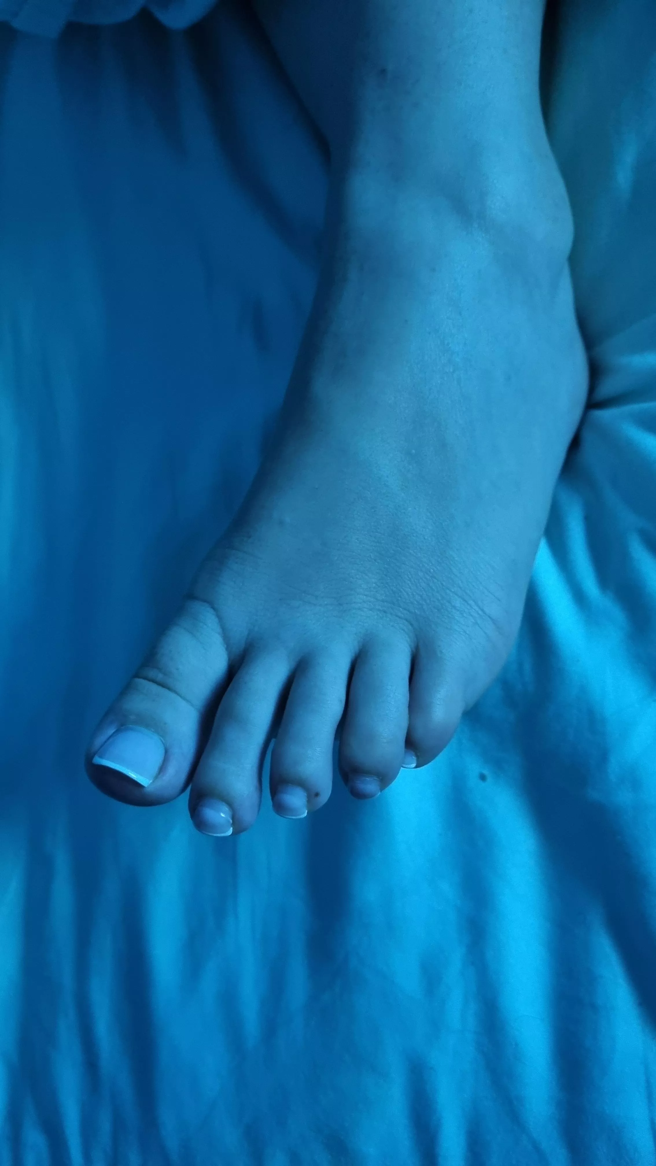 What would you do with these feet?