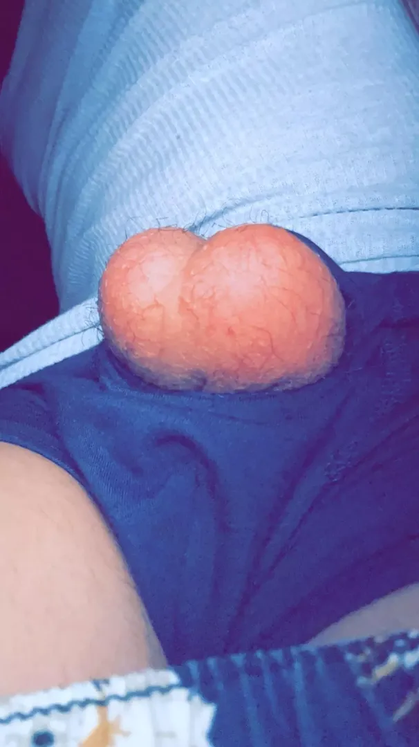 What you think?