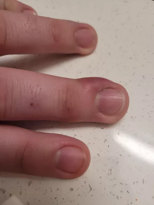 Whatever this guy is, my monkey brain wants to take an Exacto to it.