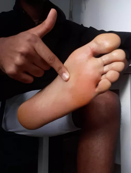 Where do you belong? Short answer: 🦶