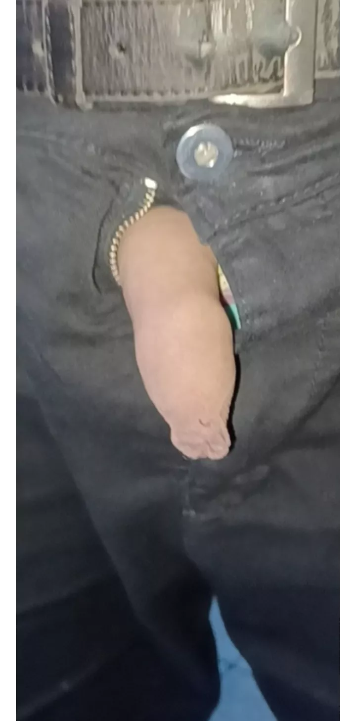 Whipped out my overhanging foreskin in public for you