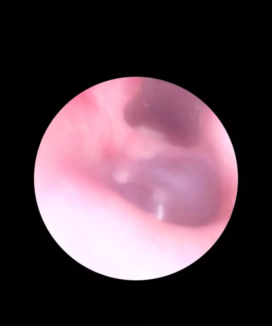 White spots in ear??