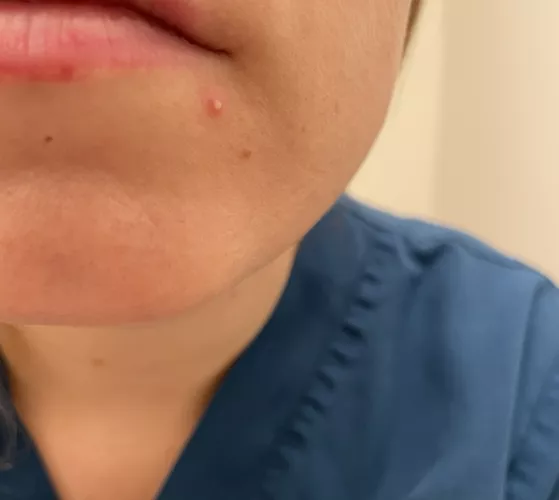 Why I don't mind still wearing a mask (pop later!)