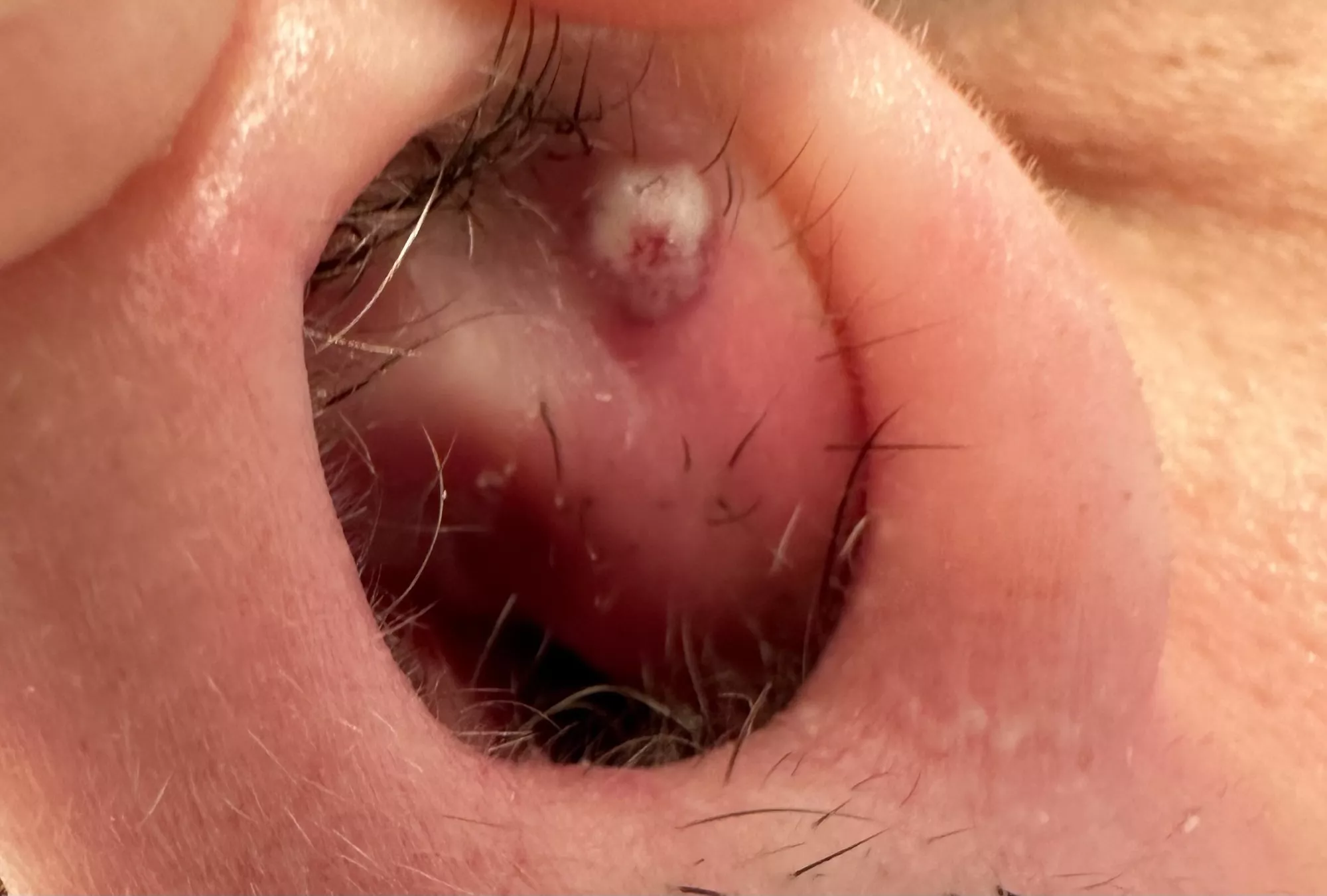 Woke up to this beast in my nostril