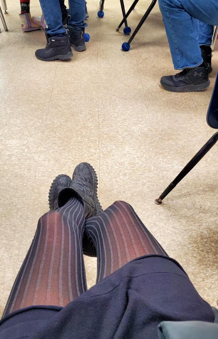 Would you stare?..