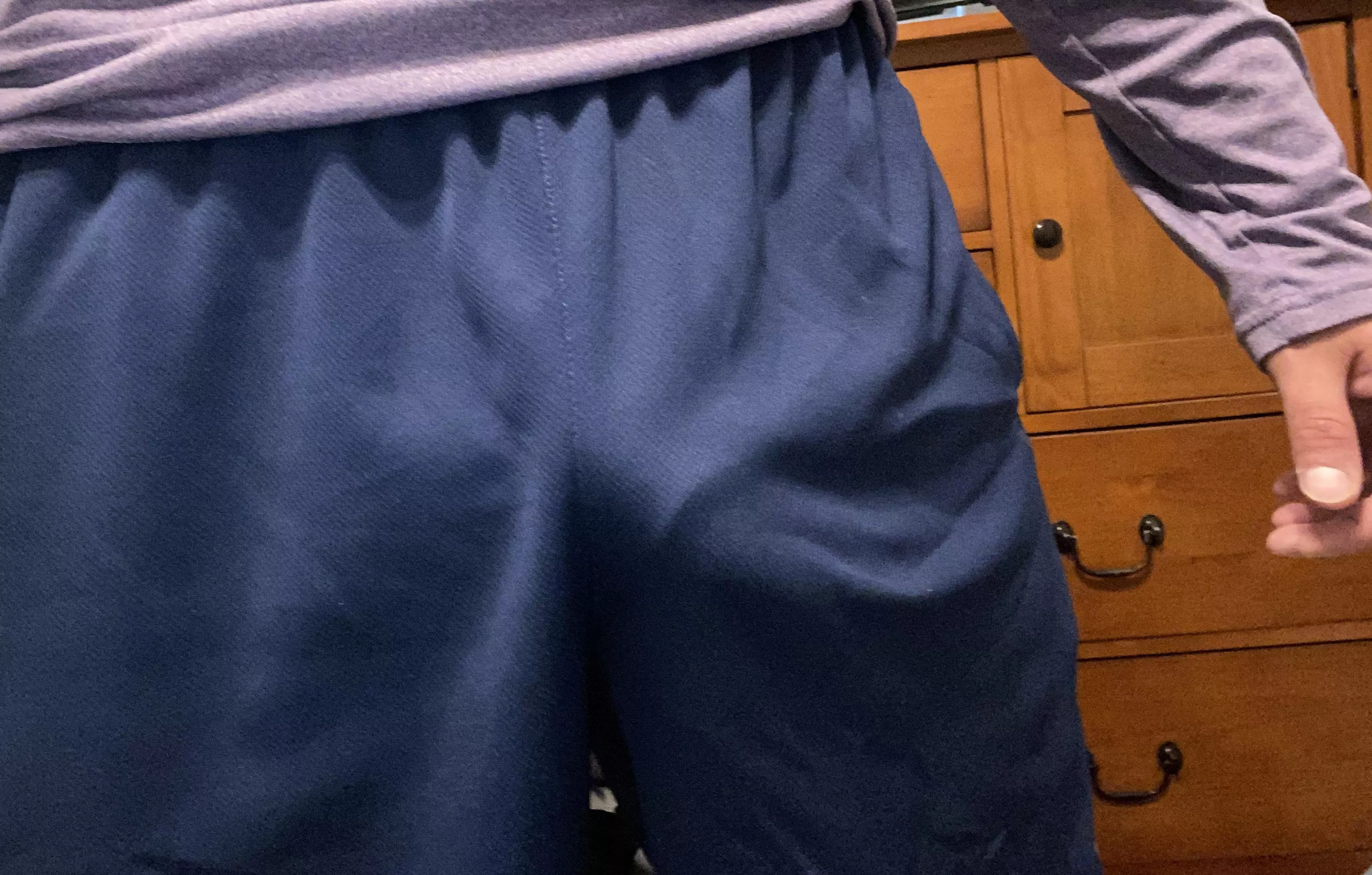 Would you stare?