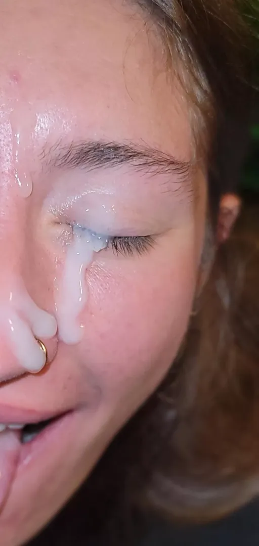 you get my other eye!